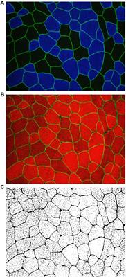 Effects of low-load resistance training with blood flow restriction on muscle fiber myofibrillar and extracellular area